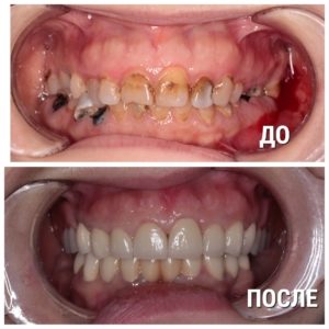 67ee180abd4289f6c892f16710f490a1-300×300