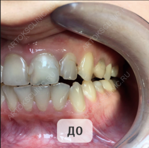 Снимок экрана 2020-09-07 в 11.04.19